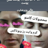 پکیج وایت رز پلاس
