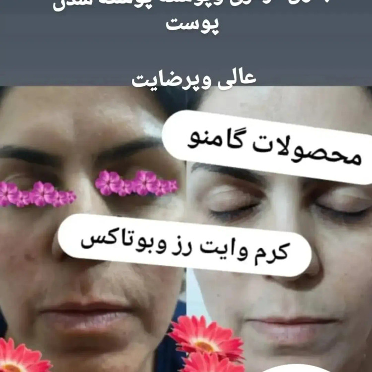 پکیج وایت رز پلاس