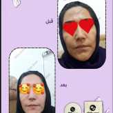 پکیج وایت رز پلاس