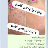 پکیج وایت رز پلاس