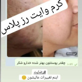 پکیج وایت رز پلاس