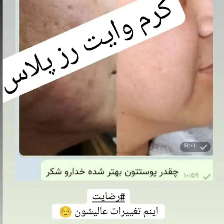 پکیج وایت رز پلاس