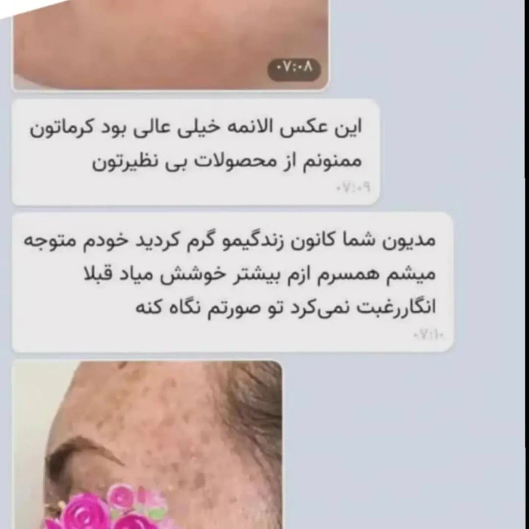 پکیج وایت رز پلاس