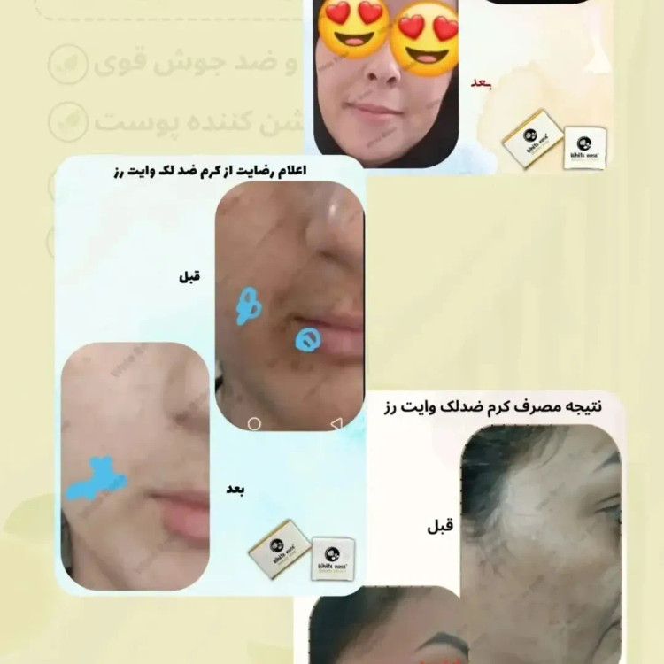 پکیج وایت رز پلاس