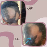 روغن کندوش گامنو اصل 60 میل | تقویت ریشه مو، کمک به کاهش ریزش و افزایش ضخامت مو