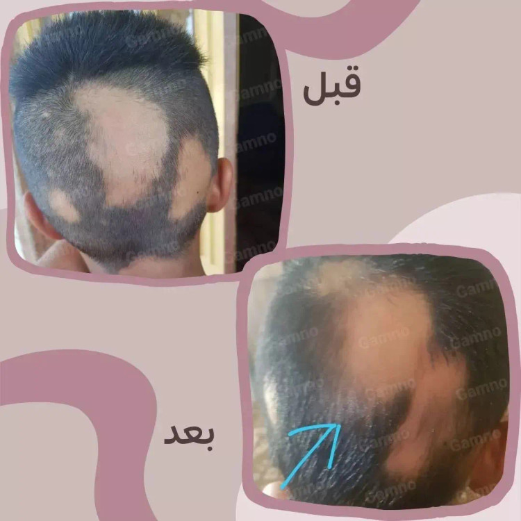 روغن کندوش گامنو اصل 60 میل | تقویت ریشه مو، کمک به کاهش ریزش و افزایش ضخامت مو
