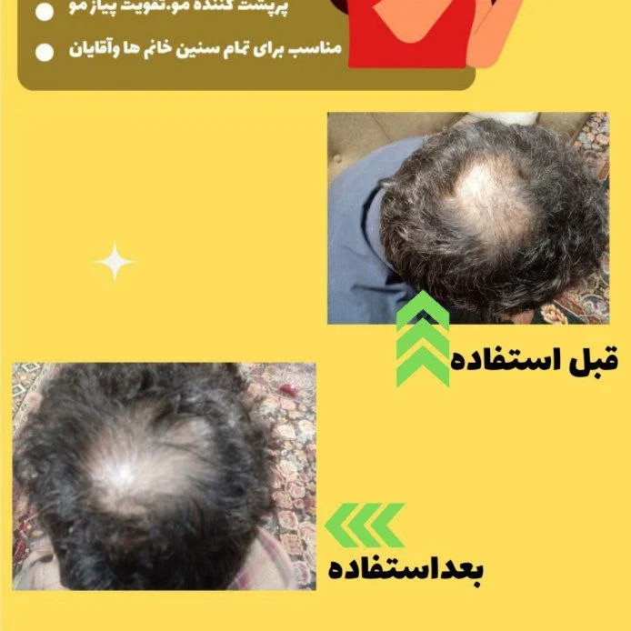 روغن کندوش گامنو اصل 60 میل | تقویت ریشه مو، کمک به کاهش ریزش و افزایش ضخامت مو