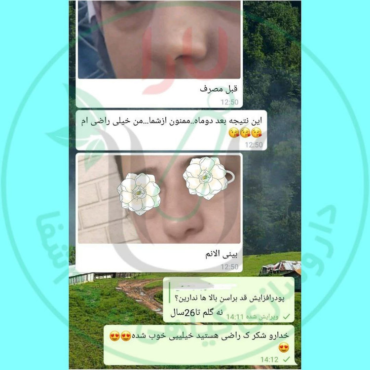 ژل کوچک کننده بینی مرهم شفای یارا