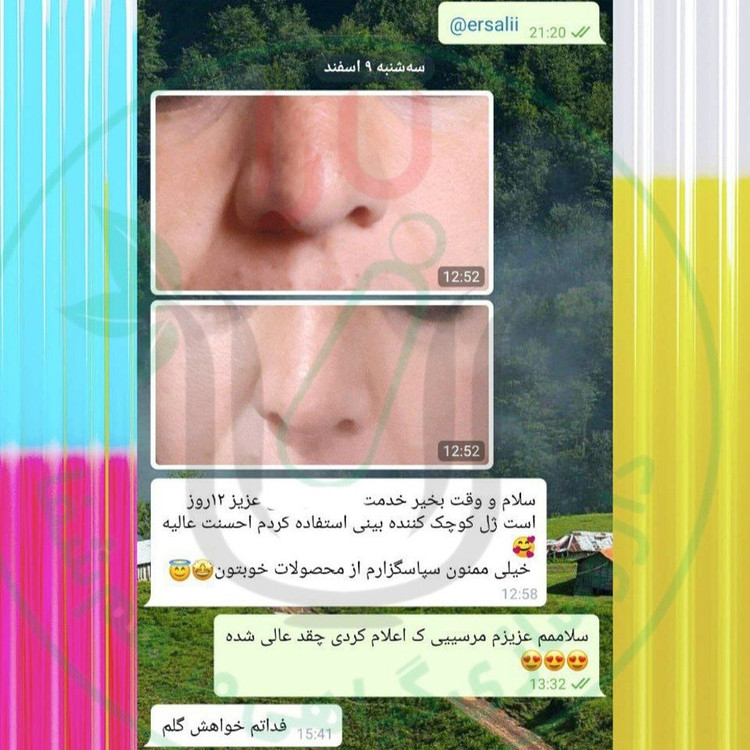 ژل کوچک کننده بینی مرهم شفای یارا