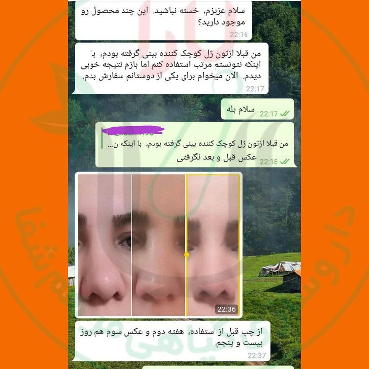 ژل کوچک کننده بینی مرهم شفای یارا