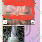ژل کوچک کننده بینی مرهم شفای یارا