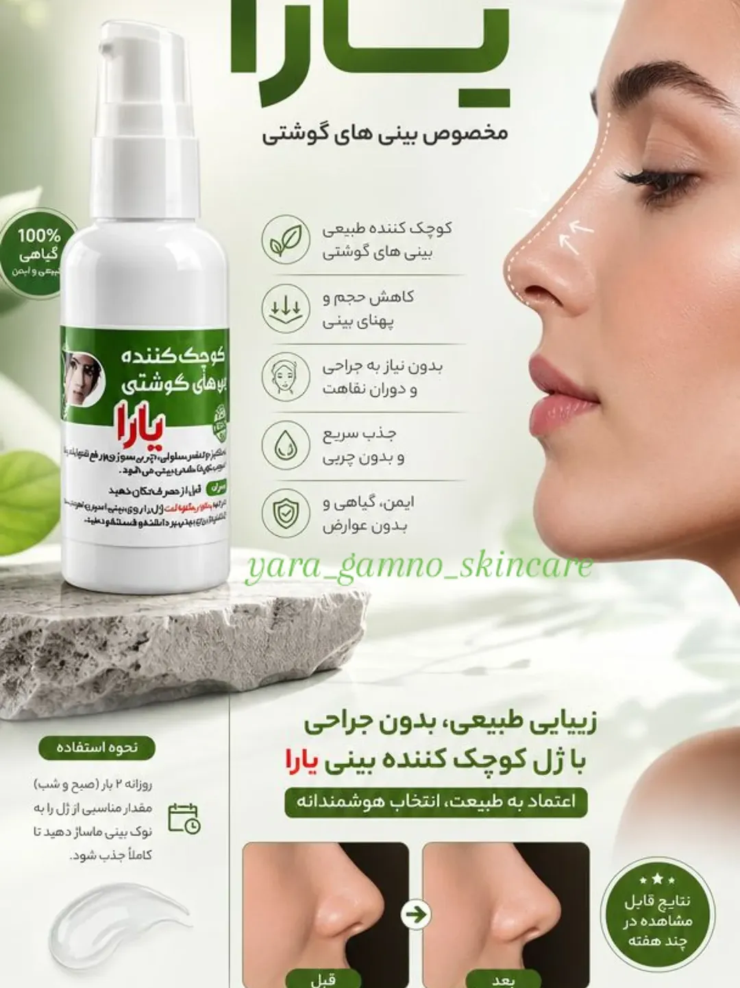 ژل کوچک کننده بینی یارا مناسب برای بینی های گوشتی