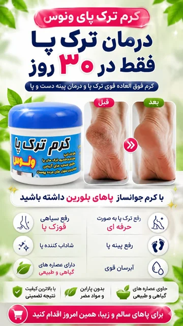 کرم ترک پاشنه پا فقط در ۳۰ روز کرم فوق العاده قوی ترک پا و درمان پینه دست و پا